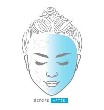 Illustration of face representing benefits of Mary Kay Clinical Solutions Ferulic + Niacinamide Brightener