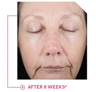 Panelist photo reflects average improvement in skin radiance and firmness after 8 weeks of use.