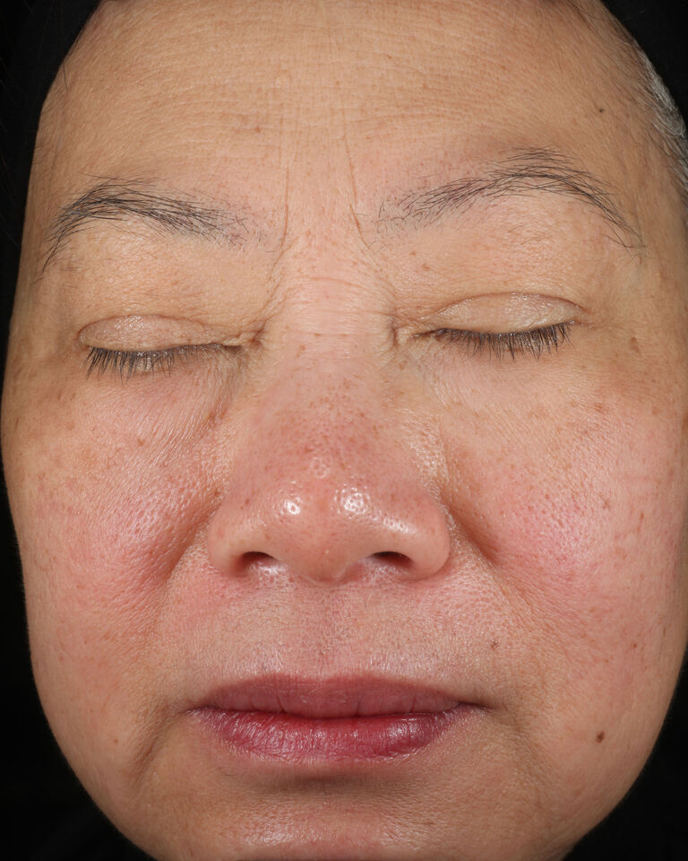 Before using Mary Kay TimeWise Replenishing Serum C+E on brow area