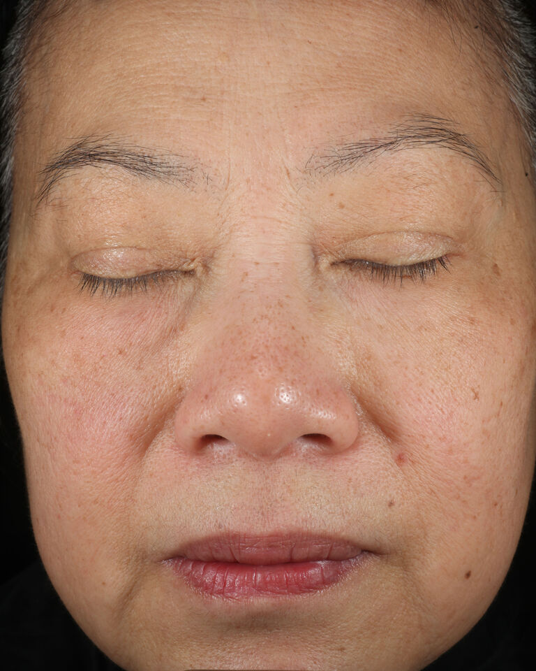 After using Mary Kay TimeWise Replenishing Serum C+E on brow area