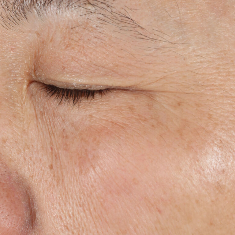 After using Mary Kay TimeWise Replenishing Serum C+E on eye area