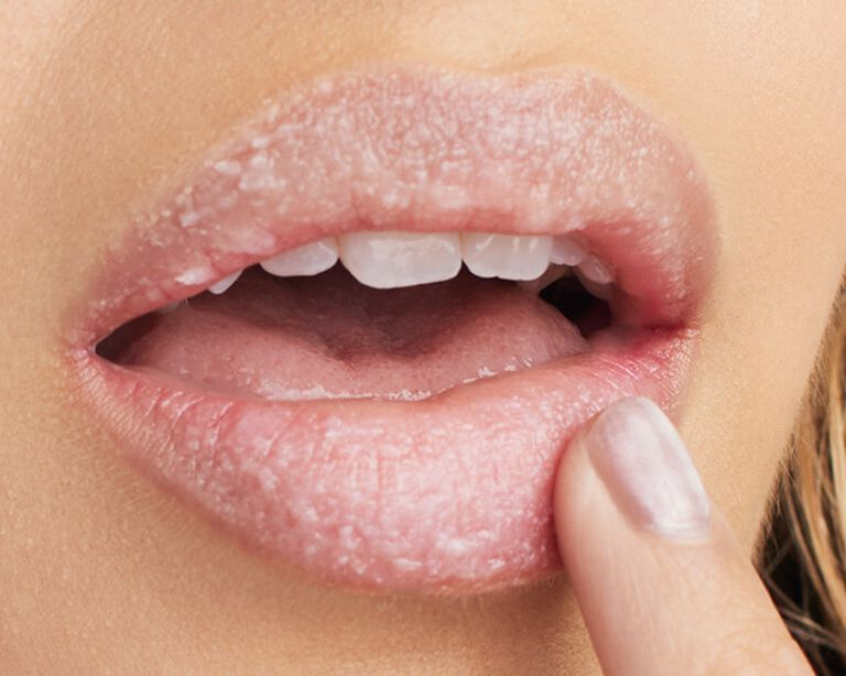Close-up of lips covered in sugar scrub next to a fingertip