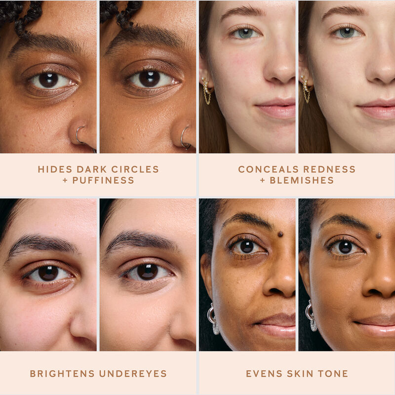 Various skin care concerns on light, medium and deep skin tones are shown as before-and-after images